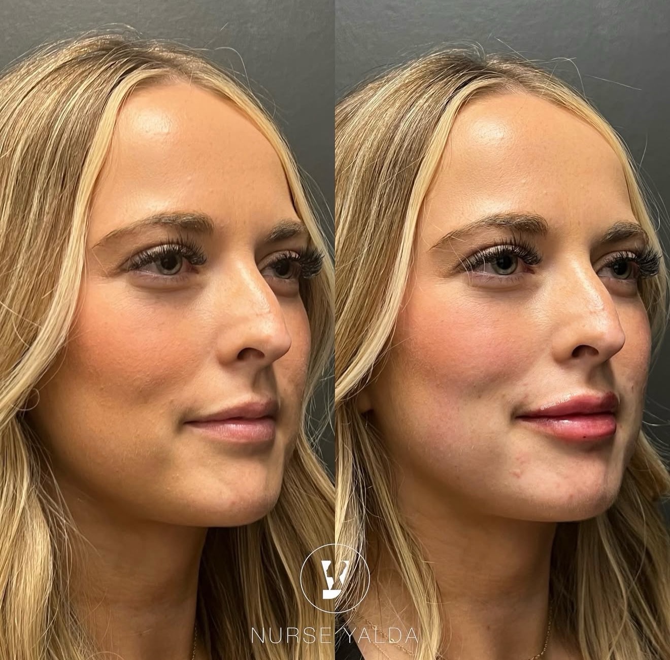 Yalda Soroush Tysons Corner, Virginia Death, Obituary: Staff At Rejuvenation Clinic Med Spa Has Died